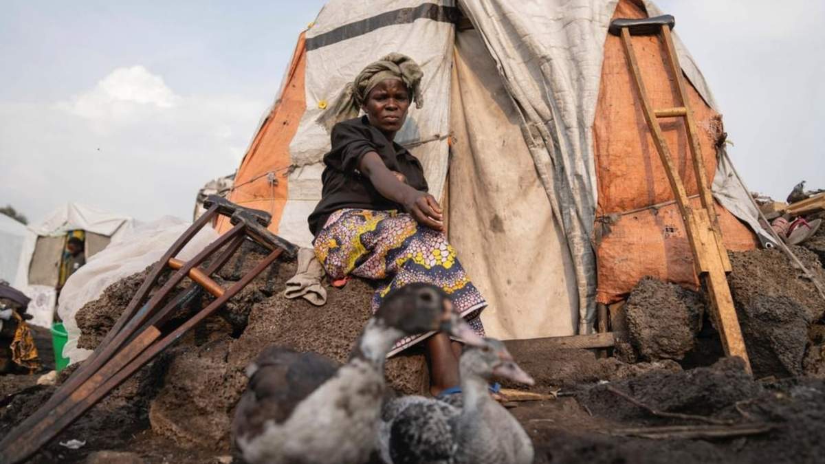 Sarah Bagheni, en el campo de refugiados de Bulengo, en Goma, República Democrática de Congo, sospecha que podría estar infectada de viruela del mono