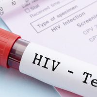 ¿Cómo afecta el coronavirus a las personas con VIH?