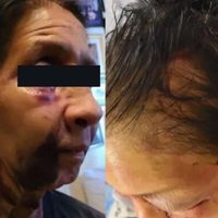 Pensó que era asiática y la golpeó brutalmente en EU; Yasmine ya fue arrestada