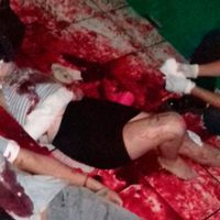 "Cierro los ojos y... veo sangre", cuenta testigo del ataque al antro Madame