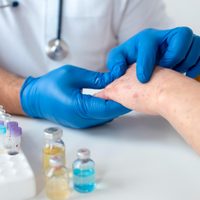 Alerta epidemiológica: cuántos casos de sarampión hay en Argentina