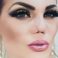 ¿Acierto o error? Las espeluznantes cirugías de los famosos