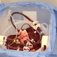 Probarán si hígado de cerdo puede usarse para tratamiento similar a diálisis