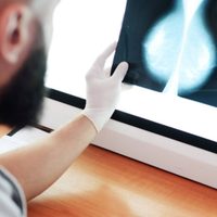 Tratamiento contra cáncer de mama ha cambiado: más curaciones, supervivencia y calidad de vida