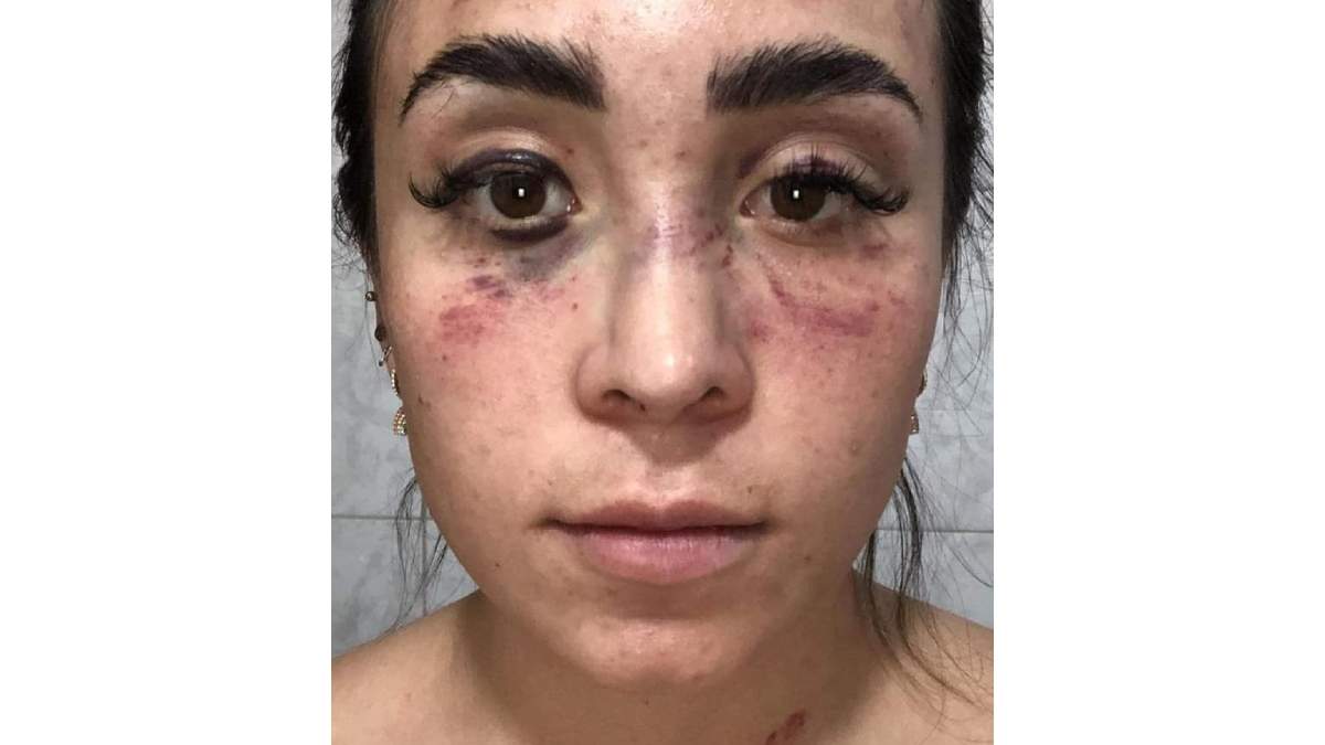 Kenya Mirelle, de 27 años de edad y con 10 semanas de embarazo