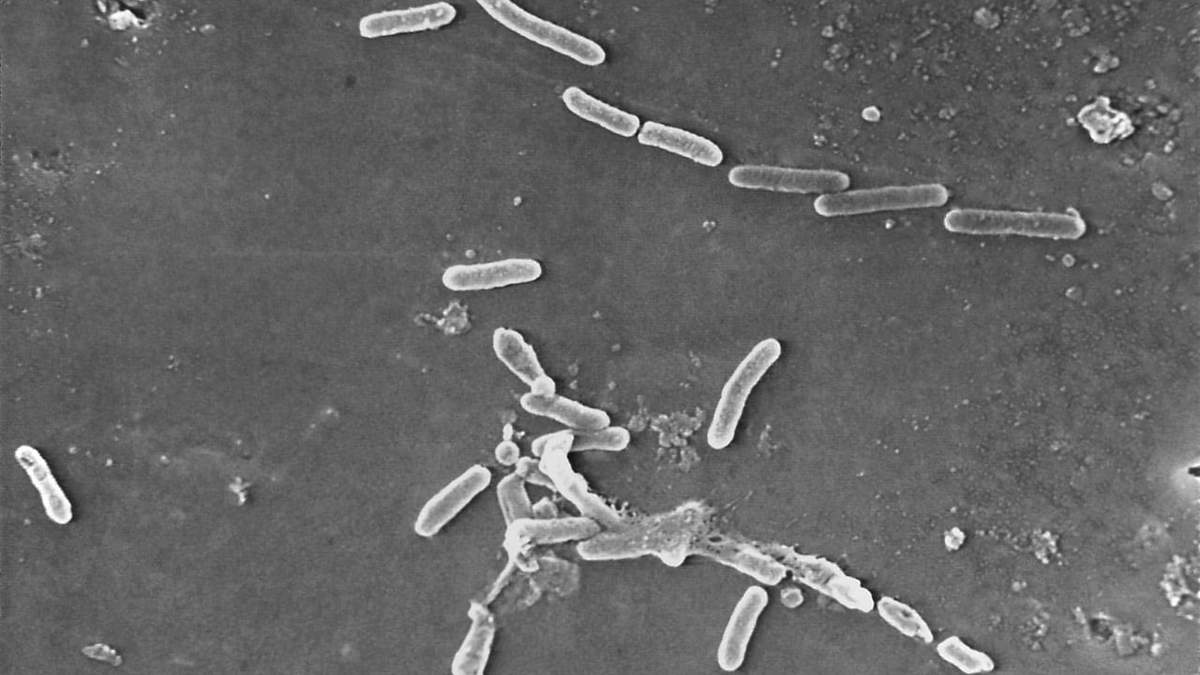 Bacteria Pseudomonas aeruginosa