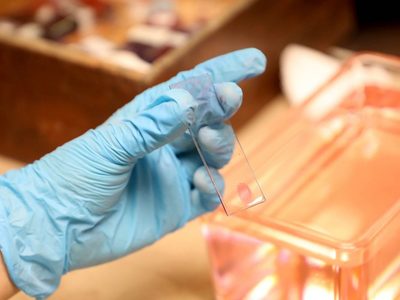 Trabajo nocturno y luz excesiva se relacionan con mayor riesgo de cáncer de mama o próstata: experta