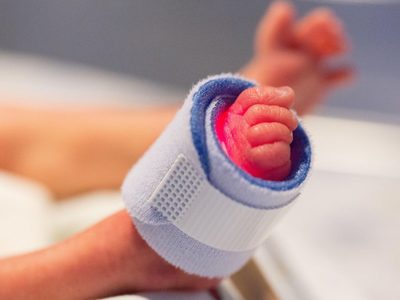 Por falta de equipo usan botella para oxigenar a bebé en IMSS de Macuspana (FOTO)