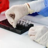 ¡Una buena! Vizzotti anunció el ingreso de 31.000 reactivos para detectar el coronavirus