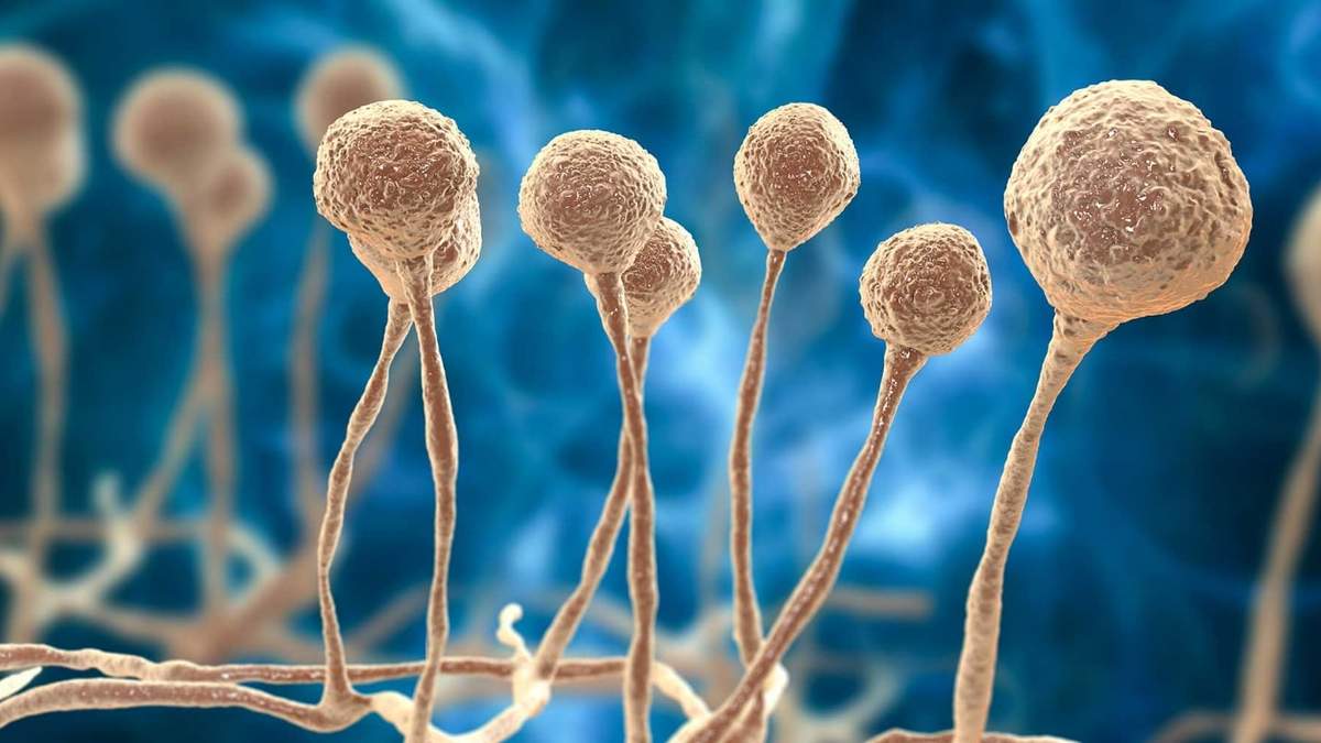 Mucromicosis, infección también conocida como "hongo negro". Fuente: (Twitter)