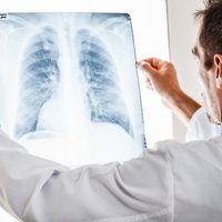 Día mundial contra el Cáncer: Según la OMS, al menos un tercio de todos los casos, pueden prevenirse