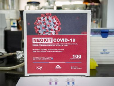 Coronavirus: el biólogo argentino que diseñó el nuevo test explicó cómo funciona
