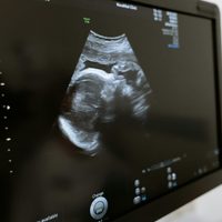 Cómo afecta la calidad de vida en la posibilidad de tener hijos
