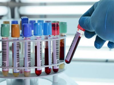 En la segunda ola de contagios, Zapala superó los 400 casos activos de coronavirus