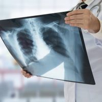 Reumatóloga advierte de que ciertas bacterias o sustancias químicas podrían desencadenar sarcoidosis