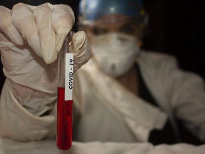 Coronavirus en el mundo: para la OMS, este es el verdadero origen de la temida enfermedad