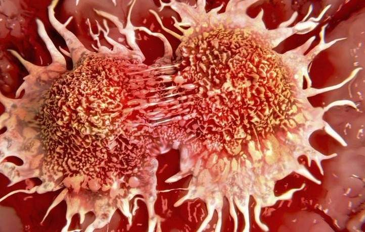 Celulas de cáncer