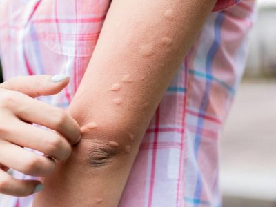 No tires los restos de las velas y prepara este excelente repelente casero de mosquitos