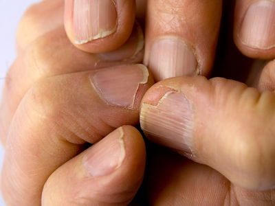 Basta de uñas quebradizas: con 1 ingrediente de tu cocina, conseguí que tu Nail Art luzca hermoso por varias semanas