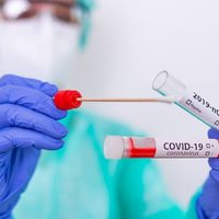 Zapala: de tener 620 casos activos de coronavirus, el número descendió a 100
