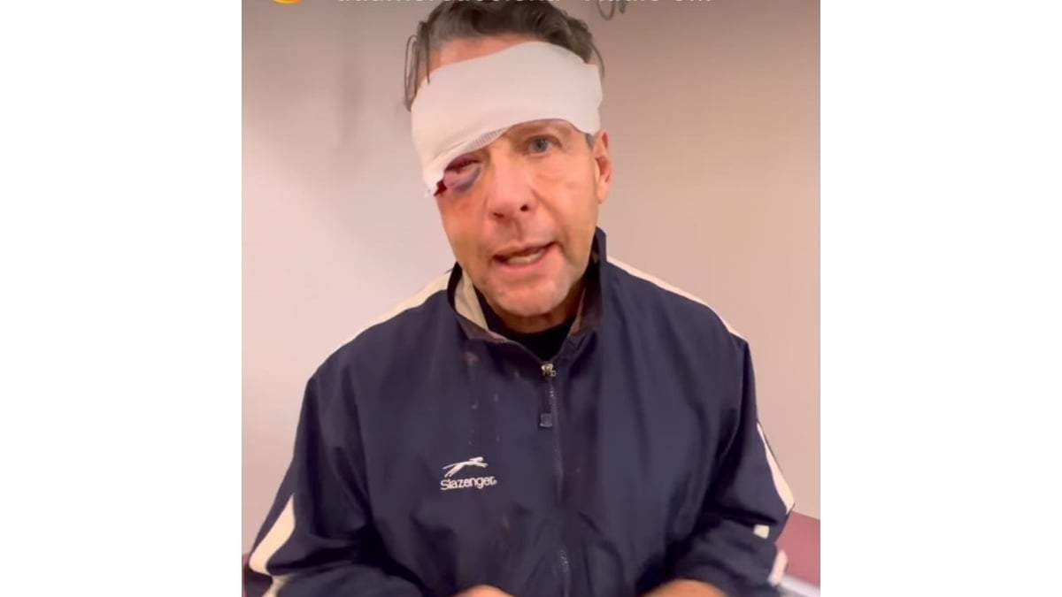 El actor Alfredo Adame, luego de ser golpeado