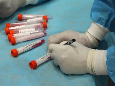 Test de coronavirus: Río Negro deja de hisopar a personas con síntomas leves y contactos estrechos