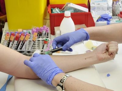 Análisis de sangre predice el riesgo de enfermedad cardiovascular en las mujeres 30 años antes
