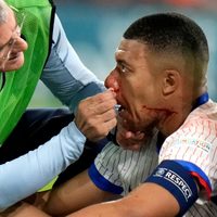 Así fue la jugada donde Mbappé se quebró la nariz en la Eurocopa (Video)