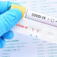 Importante autorización de la ANMAT: se podrá comprar este test rápido de coronavirus en farmacias