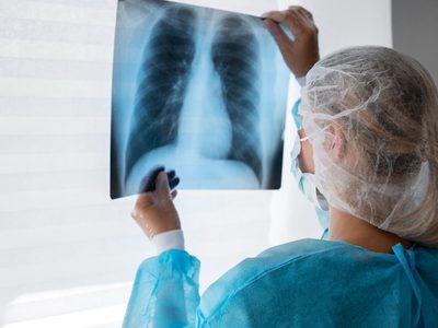 Las últimas novedades sobre avances en fibrosis quística