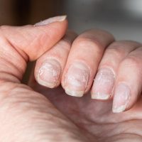 Con ingredientes muy fáciles de conseguir: así podés endurecer las uñas quebradizas
