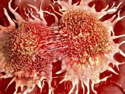 Nuevo anticuerpo humanizado podría ser eficaz contra cáncer de páncreas, según un estudio en ratones