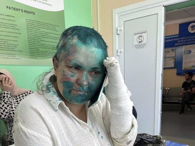 Enmascarados atacan brutalmente a periodista que destapó asesinatos y torturas de personas LGBT