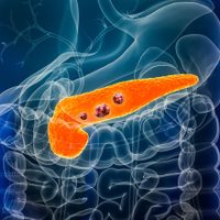 Científicos españoles lograron eliminar el cáncer de páncreas en ratones
