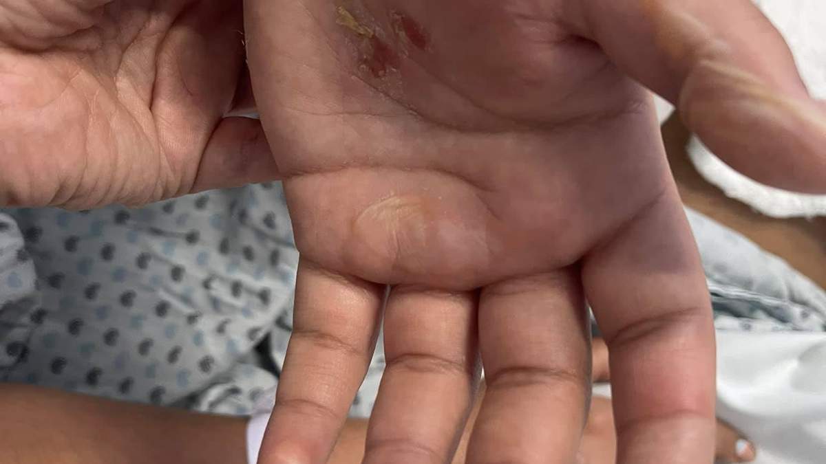 La madre de Marlene dio a conocer el ataque con ácido en redes sociales