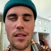 Justin Bieber canceló su gira por un virus que le provocó parálisis facial