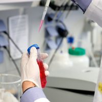 Rusia espera empezar a producir vacunas contra el coronavirus entre septiembre y octubre