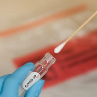 Laboratorio de La Matanza realiza hisopados en tiempo récord