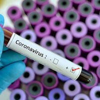 Coronavirus, caso 116: el infectado que genera alerta en Neuquén