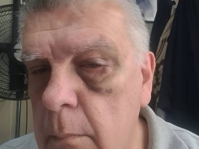 El agresor de Luis Ventura rompió el silencio, se arrepintió y negó ser un barrabrava de Central Ballester