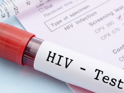 Día Mundial del Sida: Neuquén lanza un operativo con acciones coordinadas para garantizar el testeo de VIH