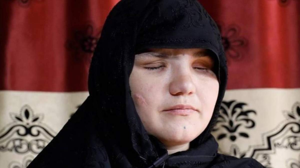 Khatera, victima de un ataque del talibán planeado por su padre