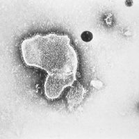Qué hay tras el repunte de virus respiratorio en niños