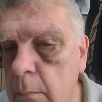 El agresor de Luis Ventura rompió el silencio, se arrepintió y negó ser un barrabrava de Central Ballester