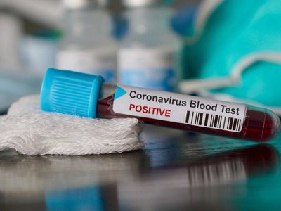 Coronavirus en Río Negro: qué dice el último parte de Salud
