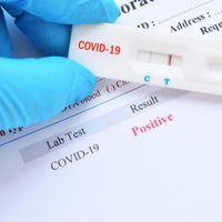 Neuquén empezó a cobrar los tests de coronavirus