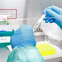 Laboratorio argentino comenzará a producir "ahora, y a riesgo", la vacuna contra el coronavirus