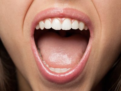 Cómo prevenir el cáncer bucal