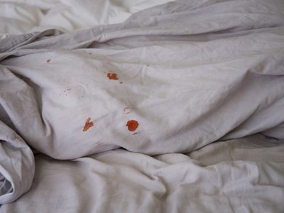 El truco para eliminar las manchas de sangre de tus sábanas y dejarlas como nuevas