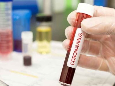 "Coronavirus en Neuquén": 31 casos sospechosos y se aguardan más resultados